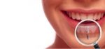 ایمپلنت دندان برای چه کسانی مناسب است؟